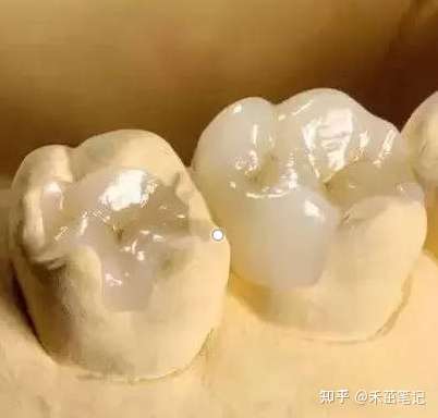 最新补牙材料，小巷中的隐秘宝藏探索